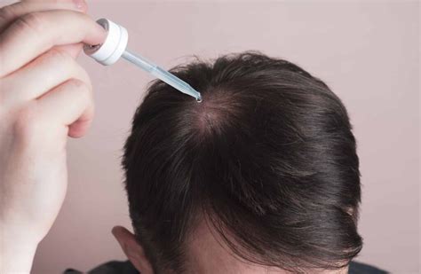 rogin-e side effects|Rogaine (Minoxidil Topical) .